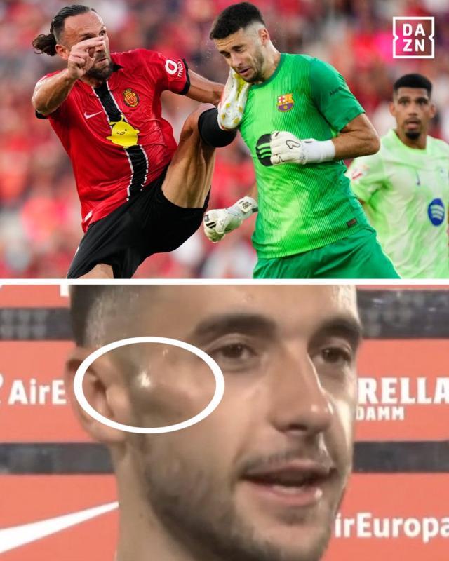 时皮球疑似 时皮球疑似